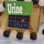 Urine Bracelet